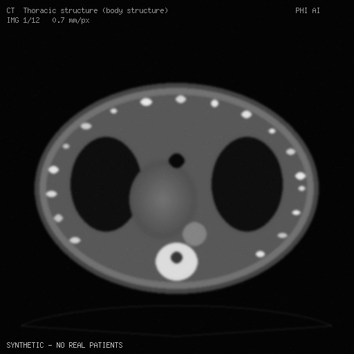 Synthetic CT frame, slice 1 of 12