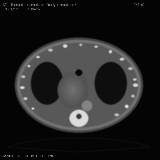 Synthetic CT frame, slice 1 of 12