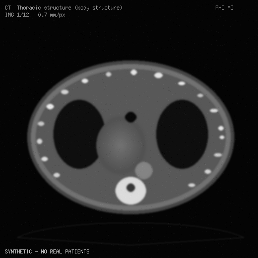 Synthetic CT frame, slice 1 of 12