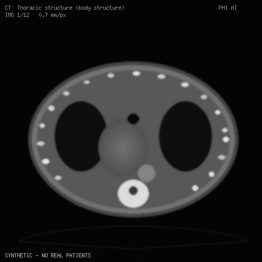 synthetic CT preview