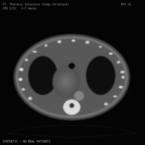 Synthetic CT frame, slice 1 of 12