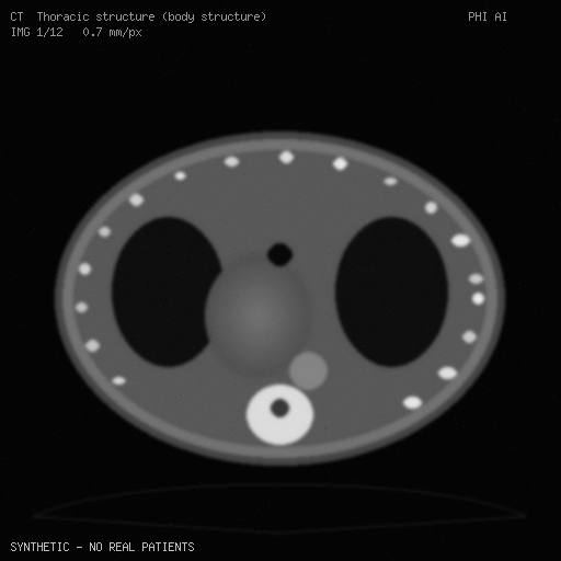 synthetic CT preview