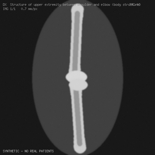 synthetic DX preview